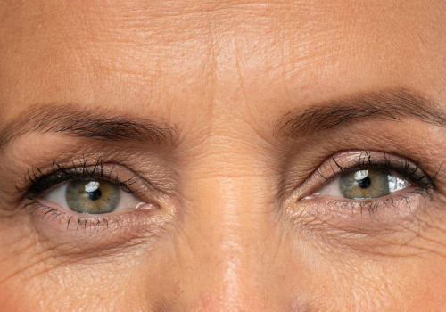 eyes